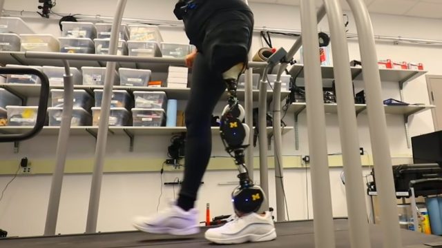 Open-Source Bionic Leg Aims To Rapidly Advance Prosthetics